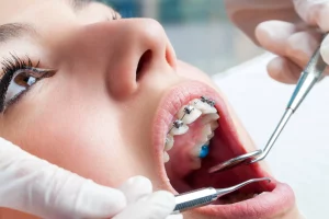 Virtual orthodontic consultations